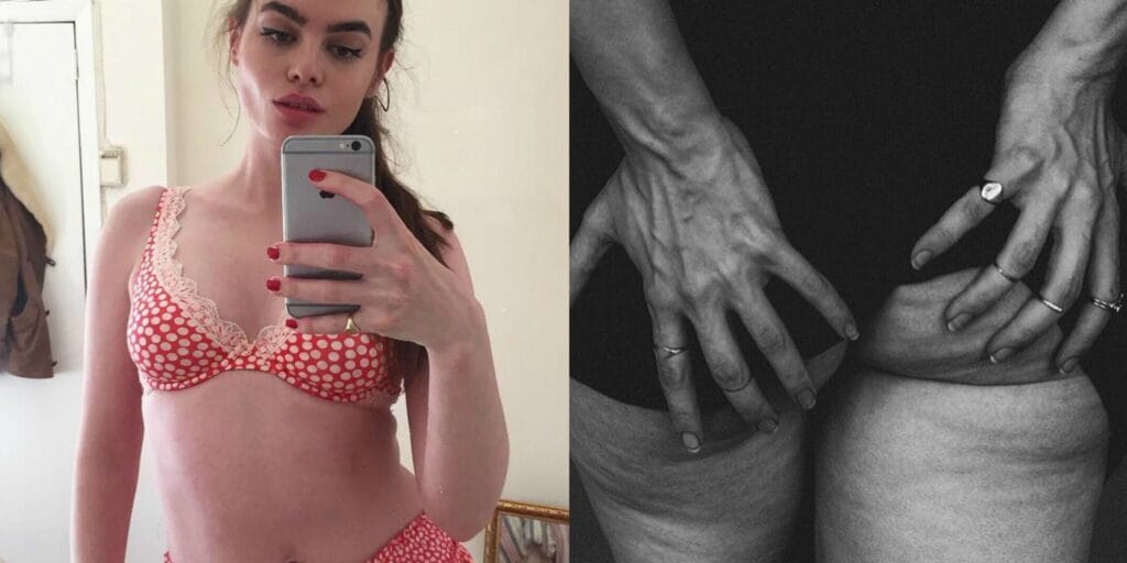 Charli-Howard-la-modella-e-orgogliosa-della-sua-cellulite