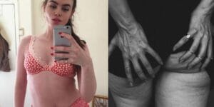Charli-Howard-la-modella-e-orgogliosa-della-sua-cellulite