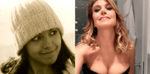 barbara-durso-rifatta-seno-naso-labbra-prima-e-dopo-ieri-e-oggi-foto