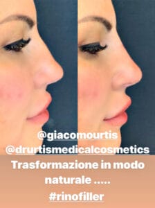 eliana-michelazzo-prima-e-dopo