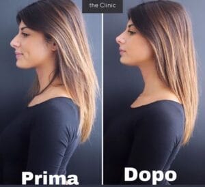 giulia-cavaglia-si-e-rifatta-il-naso-prima-e-dopo-dell-ex-tronista-di-uomini-e-donne