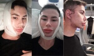 Angelo-Sanzio-operazioni-chirurgia-estetica