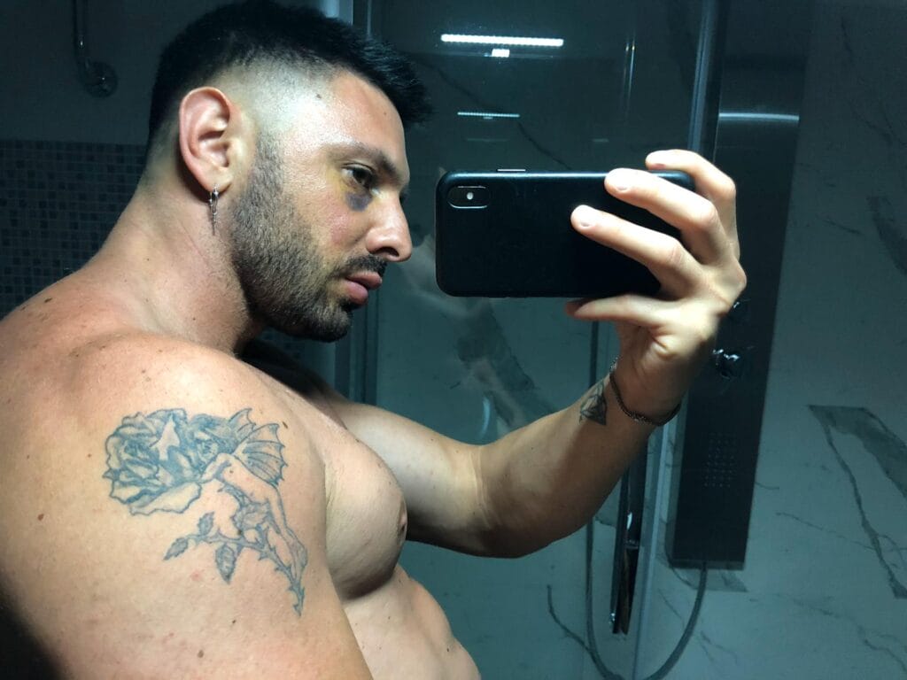 Daniele-Pompili-rovinato-dalla-chirurgia-estetica