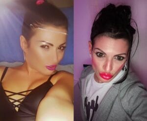 serena-rinaldi-rifatta-labbra-prima-e-dopo